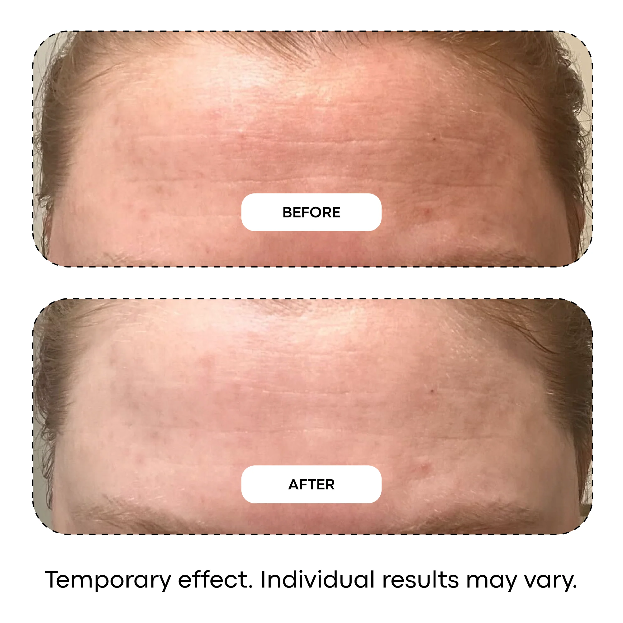 Blurring Phyto-VNM Peptide Complex™ Mask Melt - Image 7